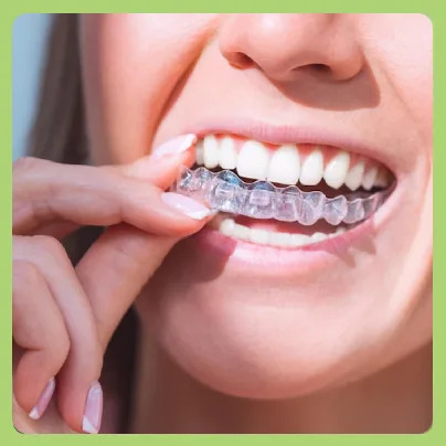 Invisalign cost in Coimbatore