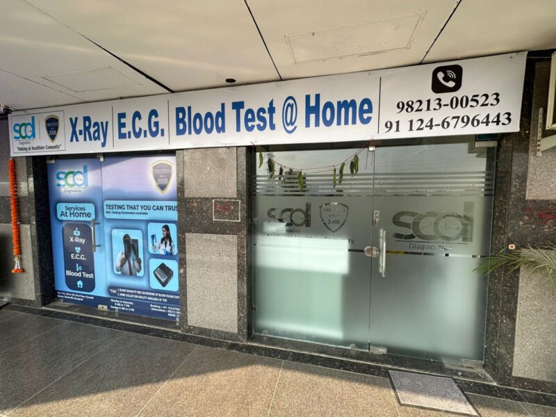 SCD Diagnostics