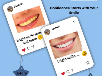 Best Dental Clinics in Anantpur, Bagaluru & Bangalore Airport – Oncodermacentre.com